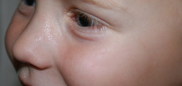 Kinderhaut braucht besonders natürliche Pflege